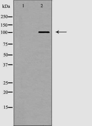 AP2A2 Antibody