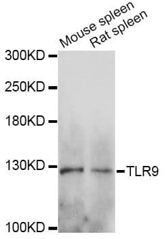 Polyclonal Rabbit anti-Human TLR9 Antibody (WB)
