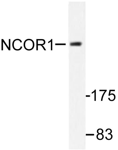 Polyclonal Rabbit anti-Human N-CoR / NCOR1 Antibody (His76, IHC, IF, WB)