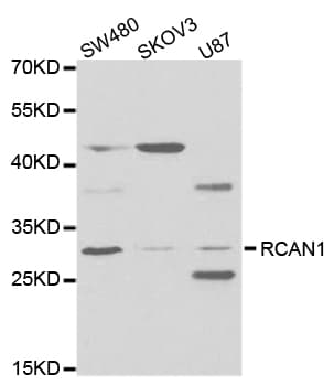 RCAN1 / DSCR1 Antibody