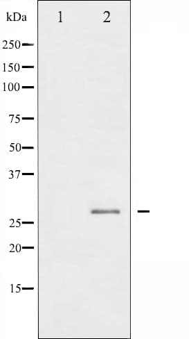 HSPB1 / HSP27 Antibody (phospho-Ser78)