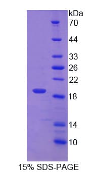 Human PDIA5 / PDIR Protein (Recombinant His-T7)