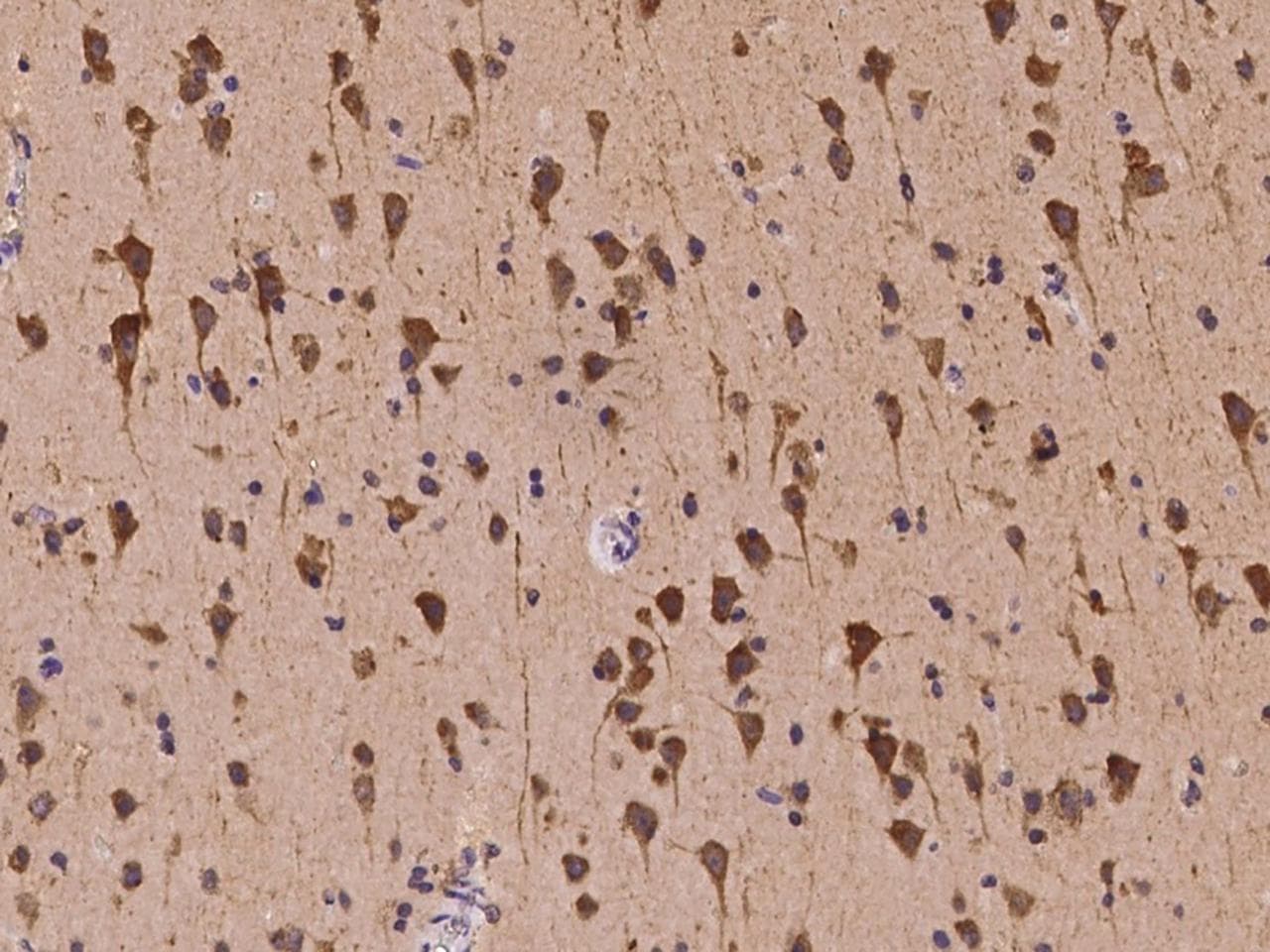 KCNQ5 Antibody