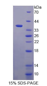 Human ITIH1 Protein (Recombinant His,N-terminus)