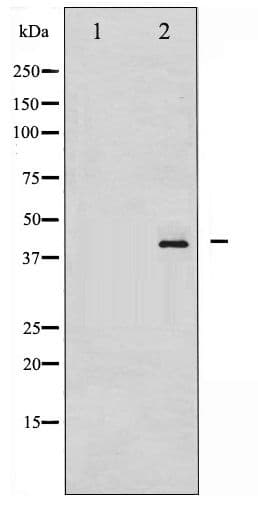 HDAC8 Antibody (phospho-Ser39)