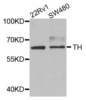Polyclonal Rabbit anti-Human TH / Tyrosine Hydroxylase Antibody (IHC, WB)