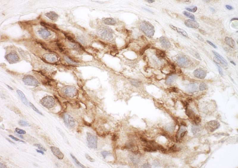 Polyclonal Rabbit anti-Human PKD2 / Polycystin 2 Antibody (aa918-968, WB)