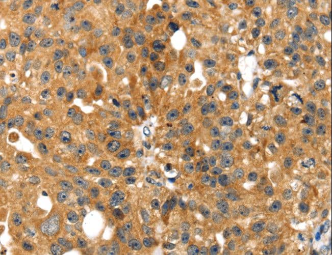 Polyclonal Rabbit anti-Human SMYD4 Antibody (IHC)