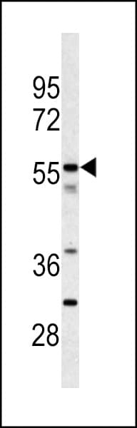 CPN2 Antibody (aa74-103)