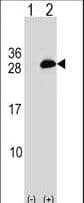 Polyclonal Rabbit anti-Human UBE2T / HSPC150 Antibody (aa126-154, WB)