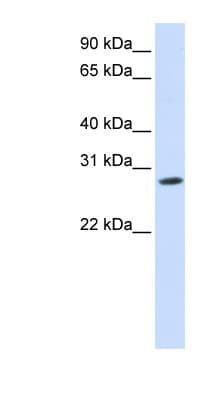 KCNIP4 / KCHIP4 Antibody (N-Terminus)