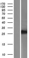 TMEM116 Protein (Over-Expression Lysate Myc-DDK (Flag))