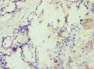 IHC-plus™ AP2A1 / AP2-Alpha Antibody (aa1-260)