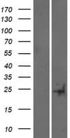 TUSC5 Protein (Over-Expression Lysate Myc-DDK (Flag))