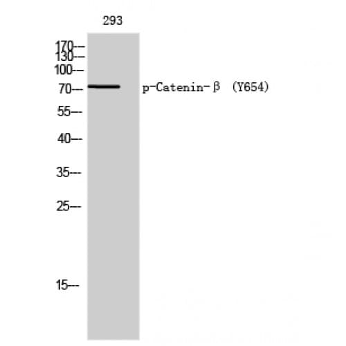 CTNNB1 / Beta Catenin Antibody (590-670 aa)