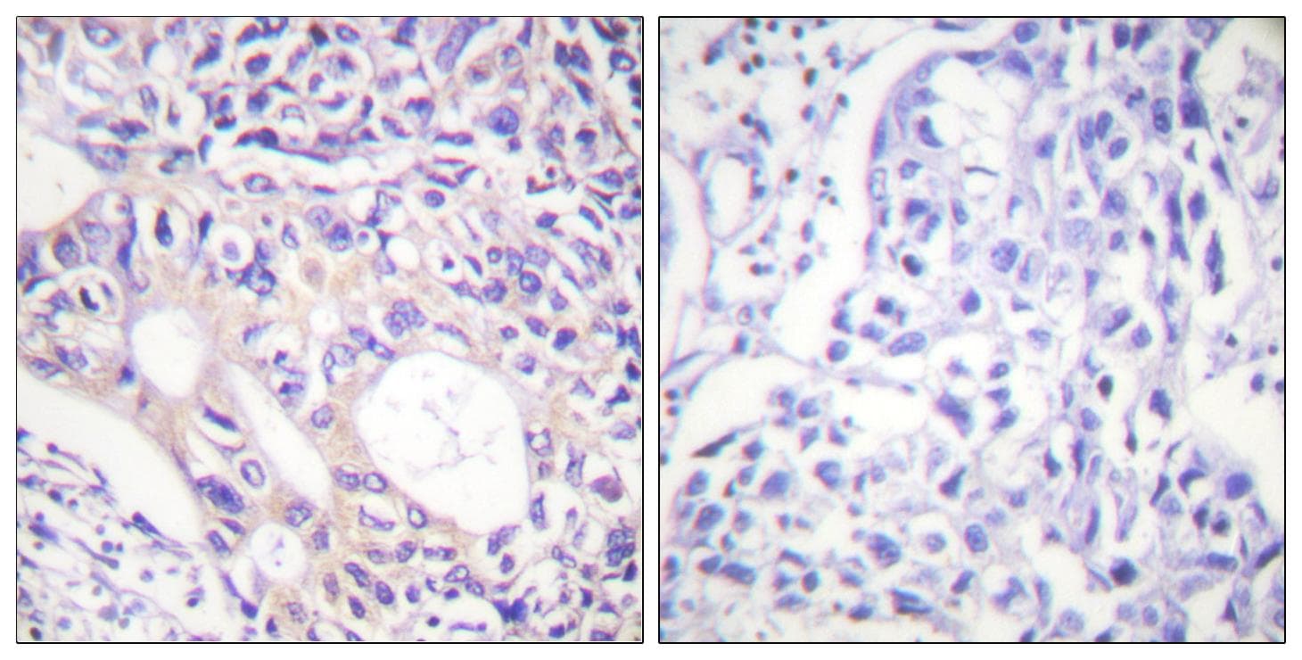 AURKA / Aurora-A Antibody (phospho-Thr288)