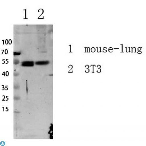 Polyclonal Rabbit anti-Human SMAD3 Antibody (Ser213, WB)