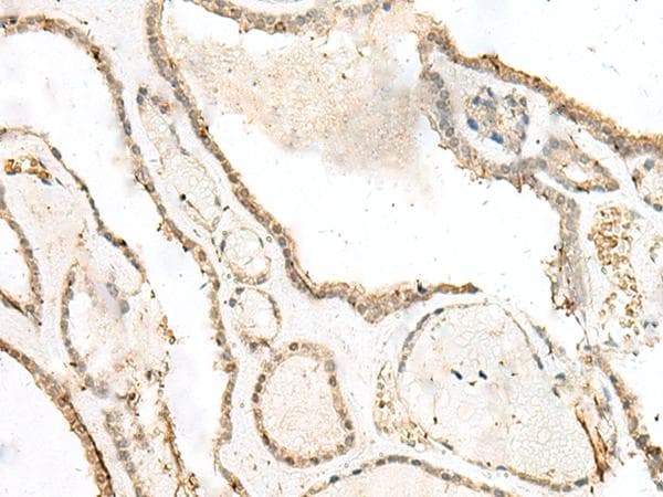 LIG4 / DNA Ligase IV Antibody
