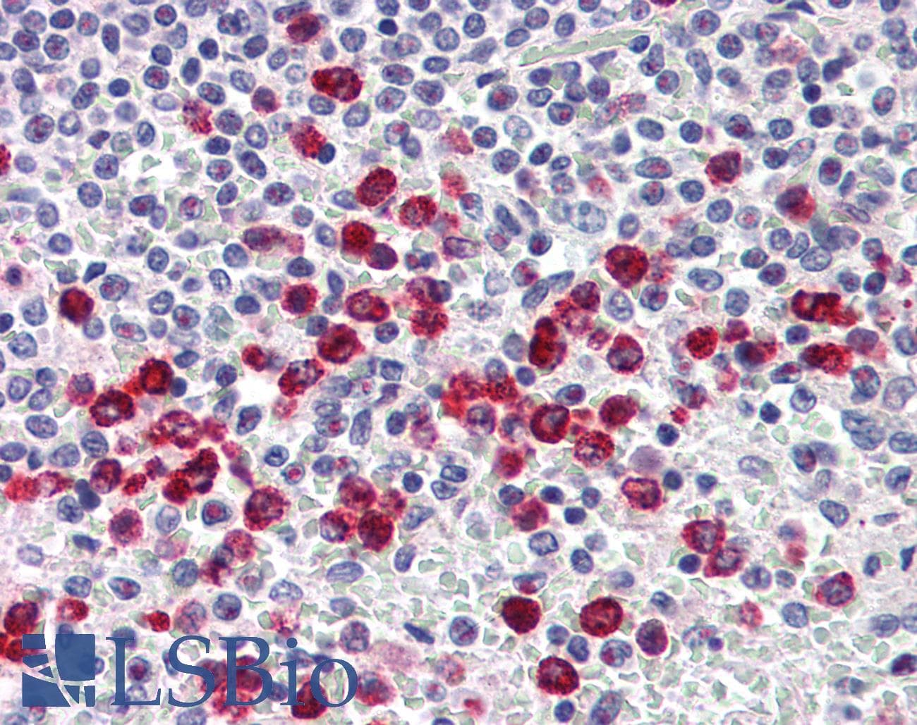 IHC-plus™ MMP9 / Gelatinase B Antibody