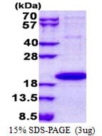 Human IL1F9 Protein (Recombinant His)