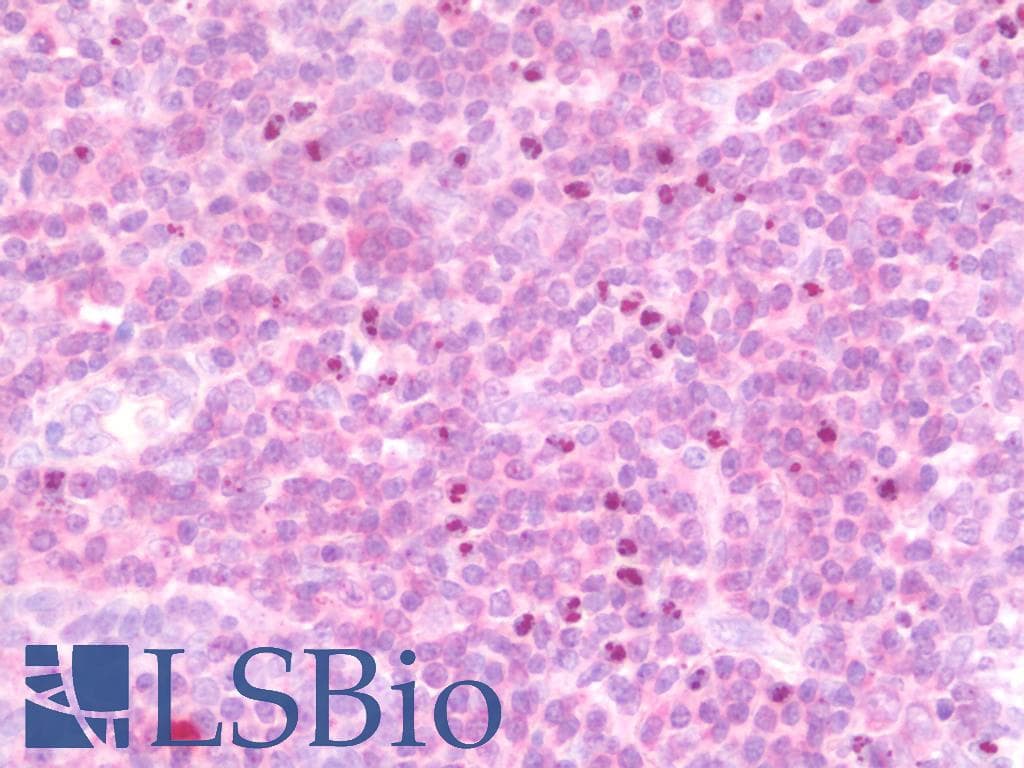 IHC-plus™ Polyclonal Rabbit anti-Human IL15 Antibody (IHC, WB)