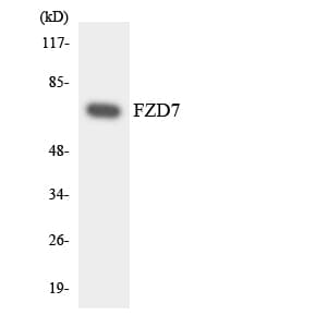 FZD7 / Frizzled 7 Antibody (aa38-87)