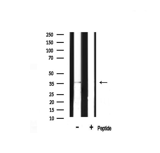 Polyclonal Rabbit anti-Human SAE1 Antibody (IF, WB)