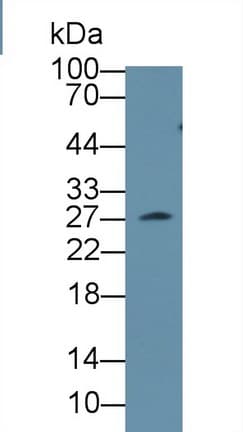 CLTA / LCA Antibody