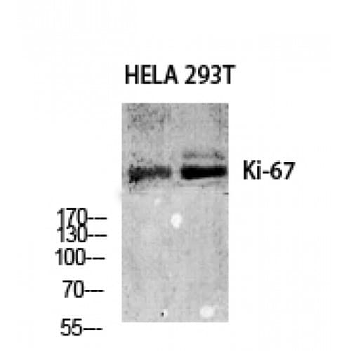 MKI67 / Ki67 Antibody (3170-3250 aa, C-terminal)
