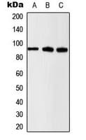 Polyclonal Rabbit anti-Human CTNNB1 / Beta Catenin Antibody (phospho-Ser37, IHC, IF, WB)