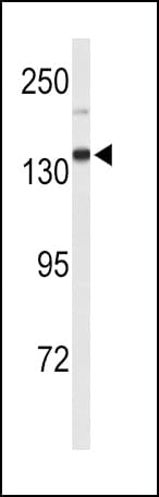XDH / Xanthine Oxidase Antibody (aa206-234)