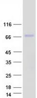 Human HEXB Protein (Recombinant Myc-DDK (Flag))