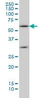Monoclonal Mouse anti-Human SOCS5 Antibody (clone 2D1, IHC, WB)