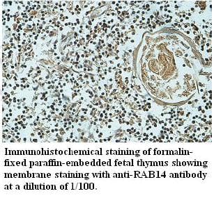 Polyclonal Rabbit anti-Human RAB14 Antibody (aa1-215, IHC, WB)
