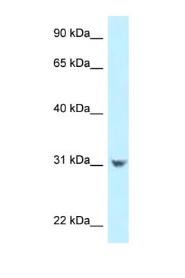 CCDC102B Antibody (aa99-148)