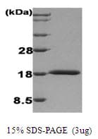 Human IFNA1 / Interferon Alpha 1 Protein (Recombinant)