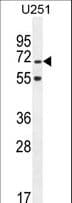 Polyclonal Rabbit anti-Human TNIP1 Antibody (aa454-482, IHC, WB)