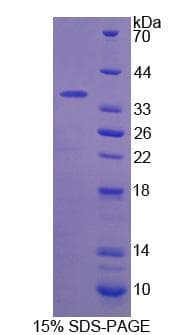 Bovine F5 / Factor Va Protein (Recombinant His-T7)