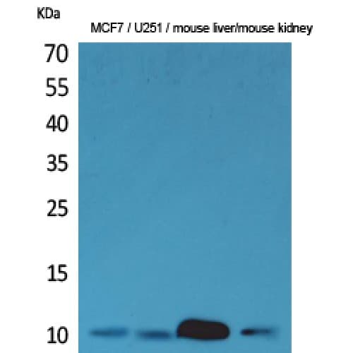 DBI / ACBD1 Antibody (C-terminal)