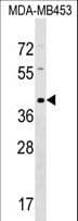 Polyclonal Rabbit anti-Human TAS2R9 Antibody (aa154-180, WB)