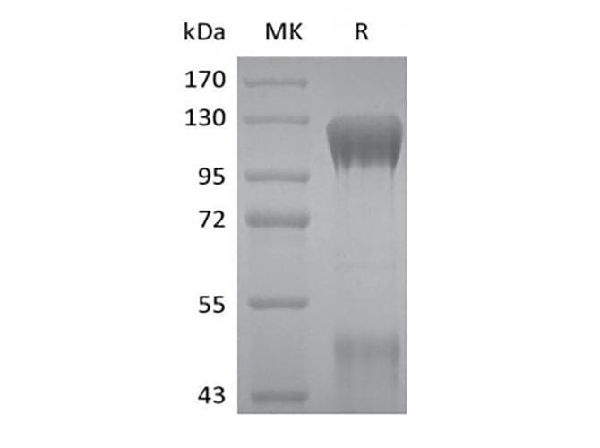 Human IGF1R / IGF1 Receptor Protein (Recombinant 6His, C-terminus)