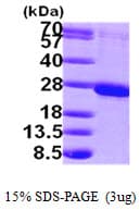 Human RAB1B Protein (Recombinant His)