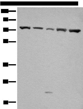 Polyclonal Rabbit anti-Human GARS / Glycyl tRNA Synthetase Antibody (WB)