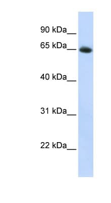 SLC2A4 / GLUT-4 Antibody (aa36-85)