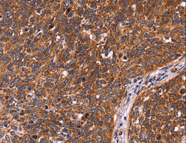 Polyclonal Rabbit anti-Human CCDC106 Antibody (IHC)