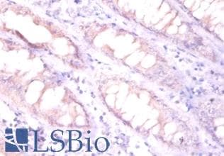 EPO / Erythropoietin Antibody