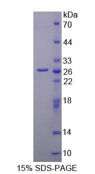 Mouse MMP2 Protein (Recombinant His, N-Terminal)