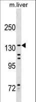 Polyclonal Rabbit anti-Human Kinesin-Like 7 / KIF15 Antibody (aa777-804, WB)