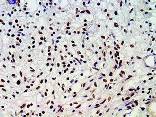 ATRX Antibody (clone BSB-108)