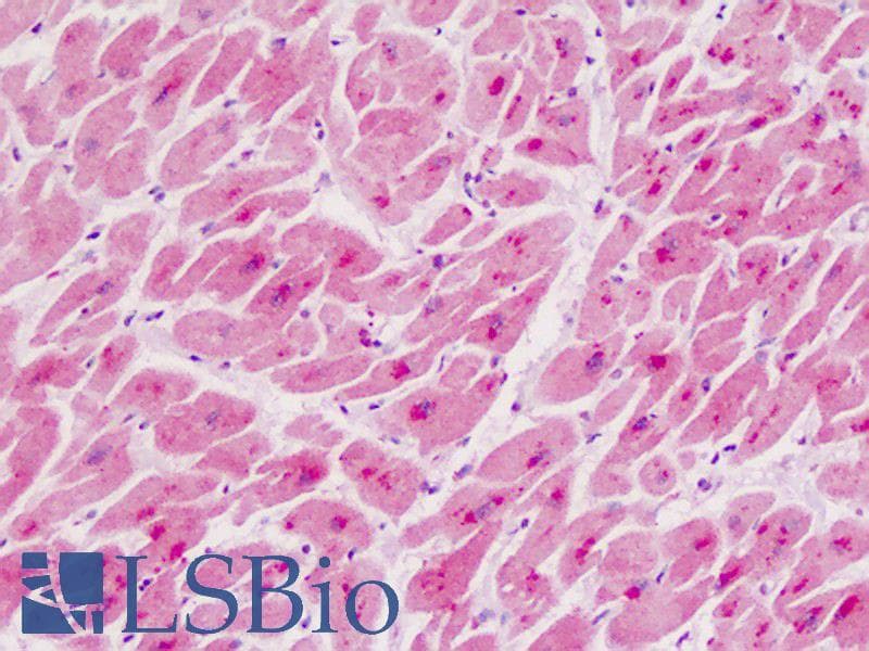 IHC-plus™ ADAMTS5 Antibody (aa331-360)